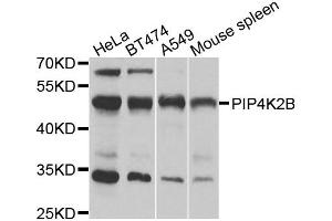 Western blot analysis of extracts of various cell lines, using PIP4K2B antibody. (PIP4K2B 抗体)