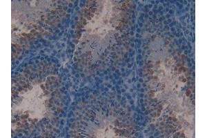 Detection of LTF in Mouse Testis Tissue using Polyclonal Antibody to Lactoferrin (LTF) (Lactoferrin 抗体  (AA 63-193))