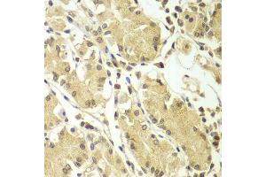 Immunohistochemistry (Paraffin-embedded Sections) (IHC (p)) image for anti-Breast Carcinoma Amplified Sequence 3 (BCAS3) (AA 674-913) antibody (ABIN6137481)