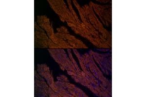 Immunofluorescence analysis of mouse heart cells using RYR2 Rabbit pAb (ABIN1513493, ABIN3020906, ABIN3020907 and ABIN6213787) at dilution of 1:200 (40x lens). (RYR2 抗体  (AA 4850-4950))