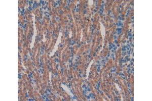 Used in DAB staining on fromalin fixed paraffin- embedded kidney tissue (RBP2 抗体  (AA 1-134))