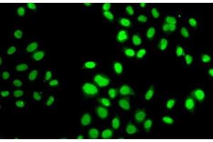 Immunofluorescence analysis of MCF7 cells using GPS1 Polyclonal Antibody (GPS1 抗体)