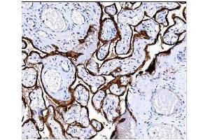 IHC analysis of Steroid Sulfatase/STS using anti-Steroid Sulfatase/STS antibody (ABIN7601166). (STS 抗体  (AA 297-547))
