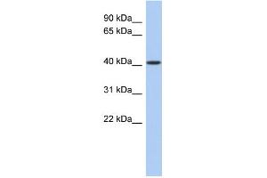 WB Suggested Anti-LASS5 Antibody Titration:  0. (LASS5 抗体  (N-Term))
