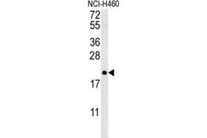 Western Blotting (WB) image for anti-Protein tyrosine Phosphatase Type IVA, Member 2 (PTP4A2) antibody (ABIN3002826) (PTP4A2 抗体)