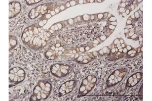 Immunoperoxidase of purified MaxPab antibody to PAGE1 on formalin-fixed paraffin-embedded human small Intestine. (PAGE1 抗体  (AA 1-146))