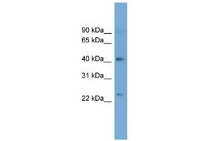 WB Suggested Anti-ATP8B2 Antibody Titration:  0. (ATP8B2 抗体  (N-Term))