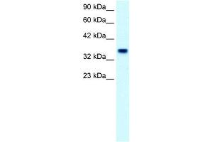 Human Placenta; WB Suggested Anti-FOXF1 Antibody Titration: 2. (FOXF1 抗体  (C-Term))