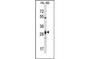 Western blot analysis of PLEKHF2 Antibody (Center) in HL-60 cell line lysates (35ug/lane). (PLEKHF2 抗体  (Middle Region))