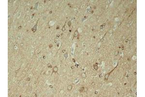 Immunohistochemical analysis of paraffin-embedded rat hippocampal region tissue from a model with Alzheimer (MAPT 抗体  (pSer396))