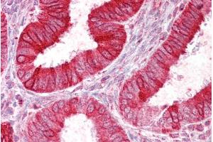 Immunohistochemistry (IHC) image for anti-Sodium Channel, Nonvoltage-Gated 1, delta (SCNN1D) (C-Term) antibody (ABIN570696)