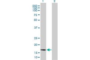 Western Blot analysis of BCL2L2 expression in transfected 293T cell line by BCL2L2 MaxPab polyclonal antibody. (BCL2L2 抗体  (AA 1-193))