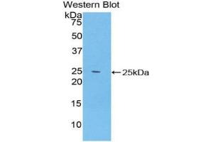 Western blot analysis of the recombinant protein. (SPRY2 抗体  (AA 116-305))