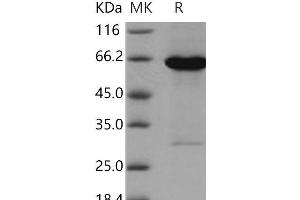 Western Blotting (WB) image for Adenosine Kinase (ADK) protein (GST tag,His tag) (ABIN7194156) (ADK Protein (GST tag,His tag))