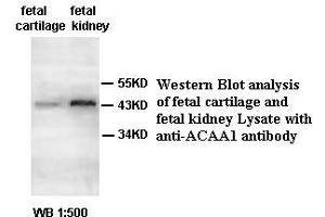 Image no. 2 for anti-Acetyl-CoA Acyltransferase 1 (ACAA1) antibody (ABIN791175) (ACAA1 抗体)