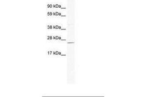 anti-DnaJ (Hsp40) Homolog, Subfamily C, Member 17 (DNAJC17) (AA 71-120) antibody