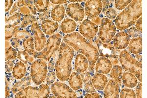 ABIN6263693 and ABIN6278598 at 1/100 staining Rat kidney tissue by IHC-P. (NOX1 抗体  (C-Term))