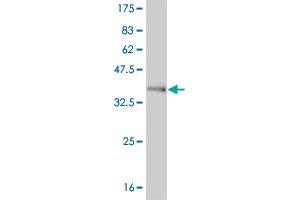 Western Blot detection against Immunogen (37. (FOXL1 抗体  (AA 132-240))