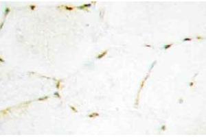 Immunohistochemistry (IHC) analyzes of Smad1/5/9 antibody in paraffin-embedded human skeletal muscle tissue. (SMAD1 抗体)