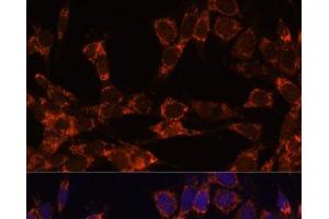 Immunofluorescence analysis of NIH-3T3 cells using UBE2F Polyclonal Antibody at dilution of 1:100. (UBE2F 抗体)