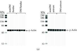 Protein expression levels in nondiabetic and diabetic gastric fundus and antrum smooth muscles. (Actin, gamma 1 抗体  (N-Term))