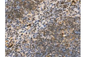 ABIN7093305 and ABIN7097324 at 1/100 staining Mouse spleen tissue by IHC-P. (TCP1 alpha/CCTA 抗体  (pSer395))