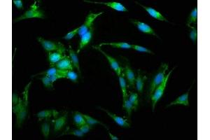 Immunofluorescence staining of Hela cells with ABIN7175826 at 1:150, counter-stained with DAPI. (WASP 抗体  (AA 145-265))