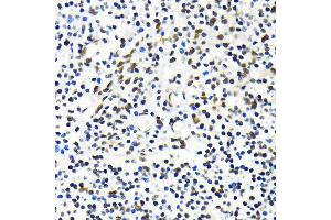 Immunohistochemistry of paraffin-embedded human tonsil using MKL1 antibody (ABIN6132380, ABIN6143855, ABIN6143858 and ABIN6224589) at dilution of 1:100 (40x lens). (MKL1 抗体  (AA 1-280))