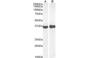 Western Blotting (WB) image for anti-Glyceraldehyde-3-Phosphate Dehydrogenase (GAPDH) (Internal Region) antibody (ABIN185543)
