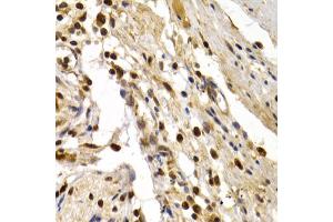 Immunohistochemistry of paraffin-embedded human colon injury using TFDP1 antibody (ABIN5973148) at dilution of 1/200 (40x lens). (DP1 抗体)