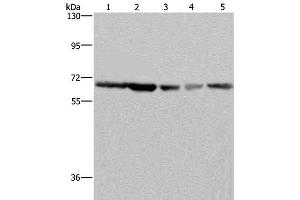 Western Blot analysis of K562, Hela, LoVo, 293T and Raji cell using GNL3 Polyclonal Antibody at dilution of 1:300 (Nucleostemin 抗体)