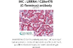 Image no. 2 for anti-Leucine Rich Repeat Neuronal 4 (LRRN4) (C-Term) antibody (ABIN1736586)