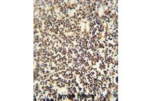 C12orf48 antibody (C-term) immunohistochemistry analysis in formalin fixed and paraffin embedded human lymph tissue followed by peroxidase conjugation of the secondary antibody and DAB staining. (PARPBP 抗体  (C-Term))