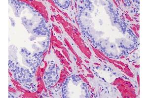 Human Prostate: Formalin-Fixed, Paraffin-Embedded (FFPE) (ACTG2 抗体  (N-Term))