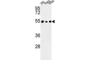Western Blotting (WB) image for anti-Protein Phosphatase 1, Regulatory Subunit 36 (PPP1R36) antibody (ABIN3003992)