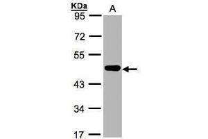 WB Image Sample(30 ug whole cell lysate) A:MOLT4 , 10% SDS PAGE antibody diluted at 1:1000 (MEK2 抗体)