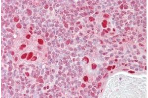 Anti-MSH5 antibody IHC staining of human thymus. (MSH5 抗体  (AA 508-519))