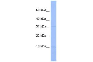 WB Suggested Anti-C18orf32 Antibody Titration: 0. (C18orf32 抗体  (Middle Region))
