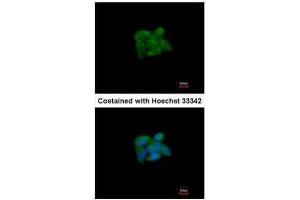 ICC/IF Image Immunofluorescence analysis of methanol-fixed HepG2, using SUOX, antibody at 1:200 dilution. (SUOX 抗体)