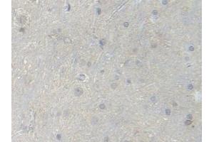 Detection of PFKM in Rat Spinal cord Tissue using Polyclonal Antibody to Phosphofructokinase, Muscle (PFKM) (PFKM 抗体  (AA 2-390))