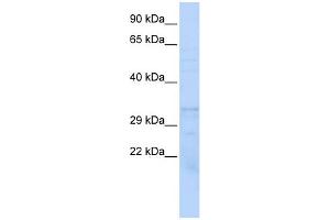 Western Blotting (WB) image for anti-Proteasome (Prosome, Macropain) Subunit, beta Type, 1 (PSMB1) (Middle Region) antibody (ABIN2786714)