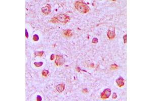 Immunohistochemical analysis of Synaptotagmin staining in human brain formalin fixed paraffin embedded tissue section. (Synaptotagmin 抗体  (Center))