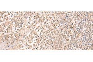 Immunohistochemistry of paraffin-embedded Human tonsil tissue using EMX2 Polyclonal Antibody at dilution of 1:25(x200)