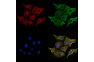 ABIN7094651 and ABIN7098702 staining Hela cells by IF/ICC.