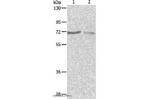 Western blot analysis of A375 and A431 cell, using PTPN6 Polyclonal Antibody at dilution of 1:500 (SHP1 抗体)