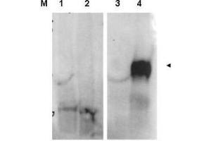 Image no. 1 for anti-Fibroblast Activation Protein, alpha (FAP) (Internal Region) antibody (ABIN1101478) (FAP 抗体  (Internal Region))