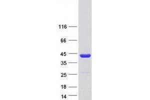 Western Blotting (WB) image for Nascent Polypeptide Associated Complex alpha 1 (NACa1) (Transcript Variant 3) protein (Myc-DYKDDDDK Tag) (ABIN2726835)