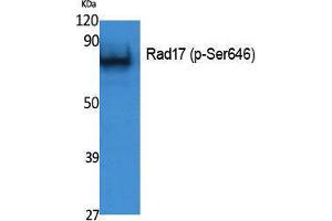 Western Blotting (WB) image for anti-RAD17 (RAD17) (pSer646) antibody (ABIN3183071) (RAD17 抗体  (pSer646))