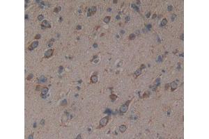 Used in DAB staining on fromalin fixed paraffin- embedded Kidney tissue (PRODH 抗体  (AA 392-599))
