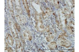 Immunostaining (ISt) image for anti-V-Akt Murine Thymoma Viral Oncogene Homolog 1 (AKT1) (AA 1-480) antibody (ABIN559829)